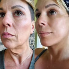 NAD+ EGF Firming Serum